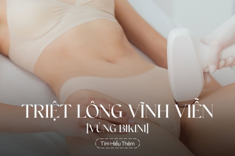 Triệt lông vùng bikini vĩnh viễn